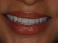 Konig Center for Cosmetic & Comprehensive Dentistry smile photos
